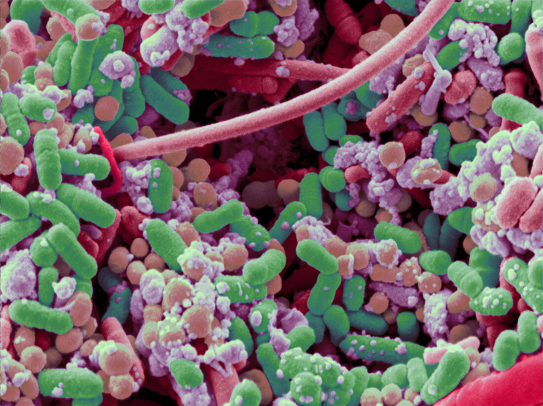 Bacteria in Human Tonsil Pus, SEM
