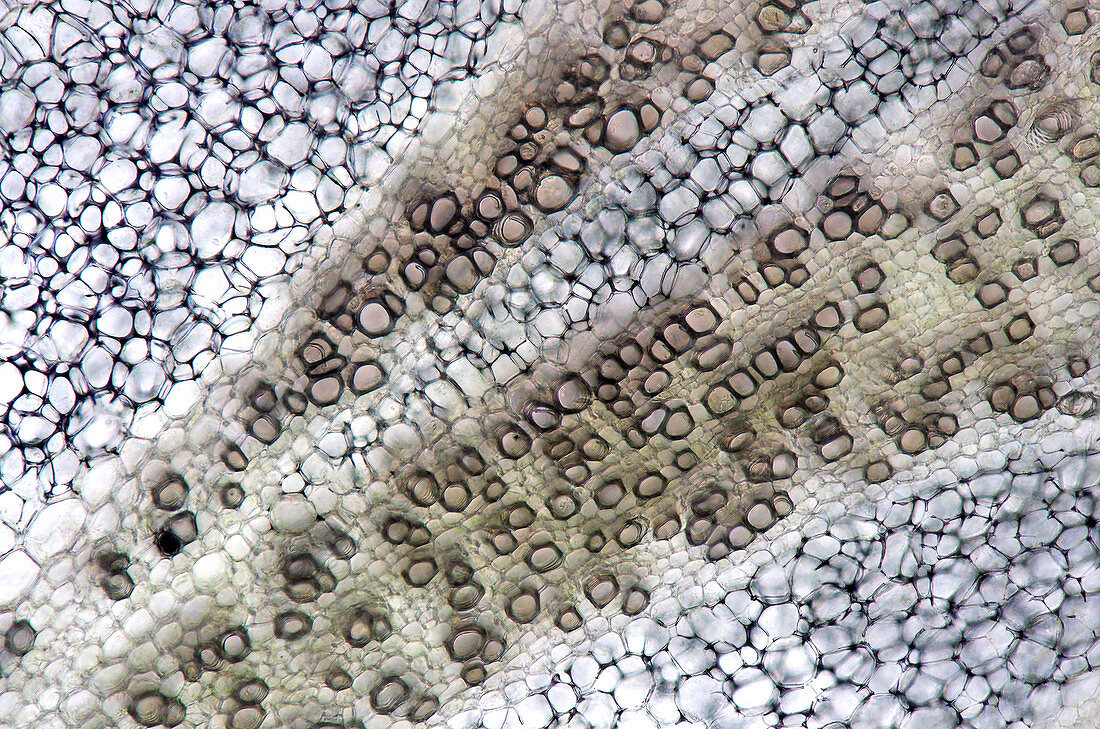 Broccoli stalk, Bright-field micrograph