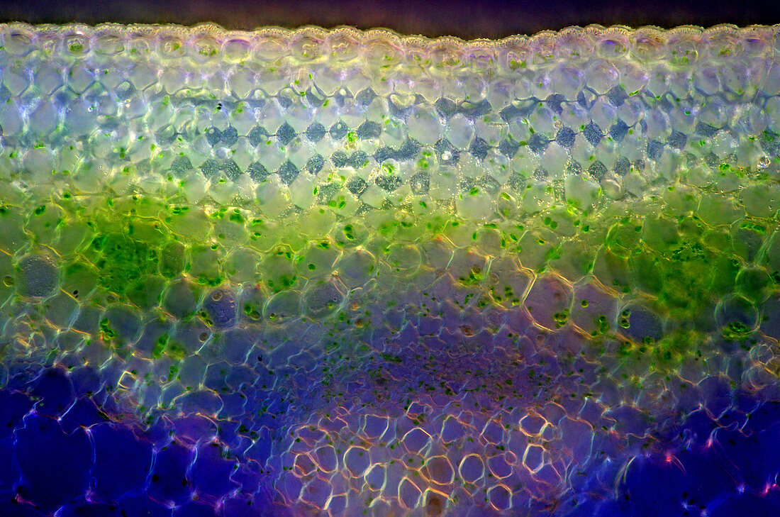 Dahlia Tissue, Polarized LM