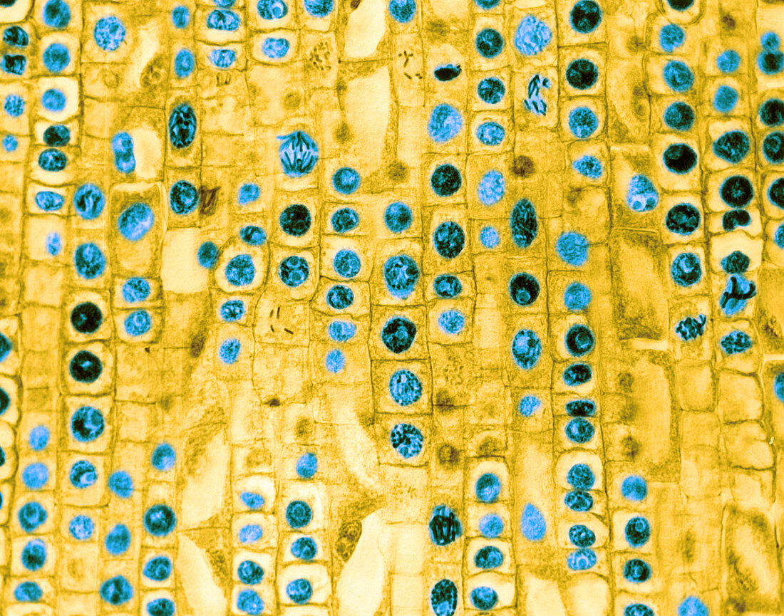 Hyacinth Root Tip Cells