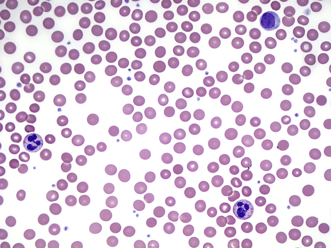 Blood Smear, LM