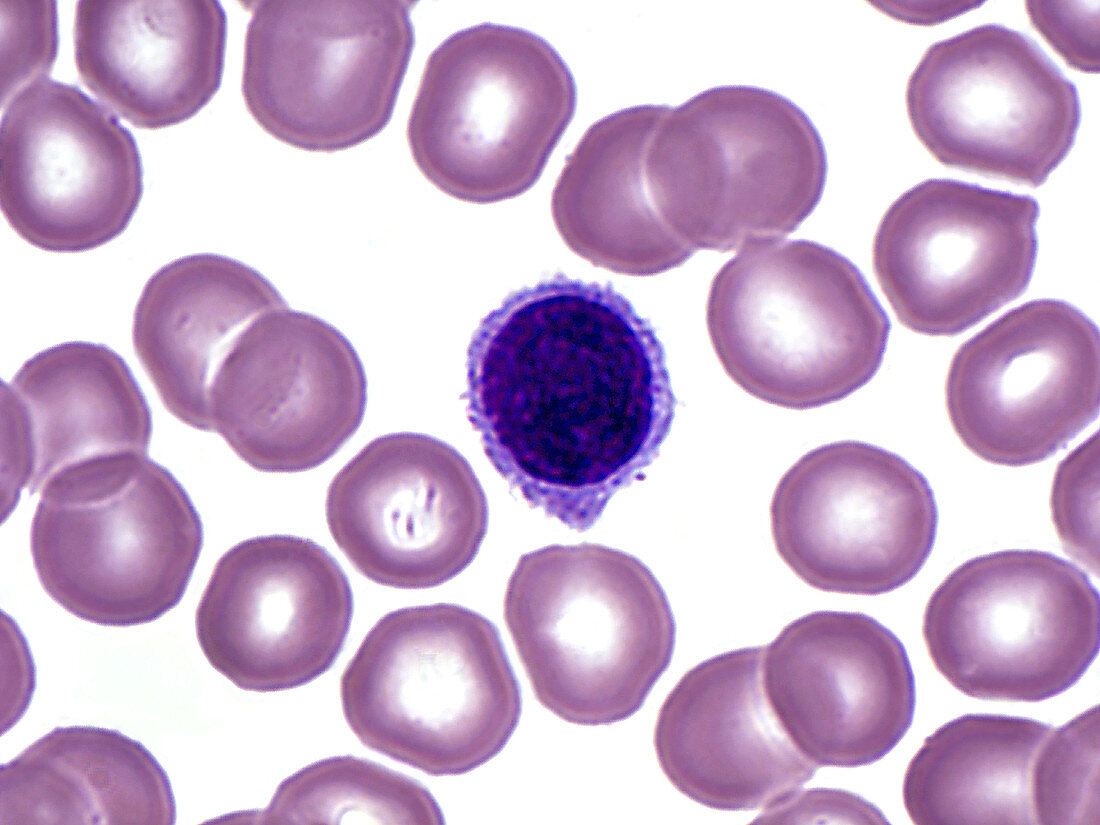 Blood Smear, LM