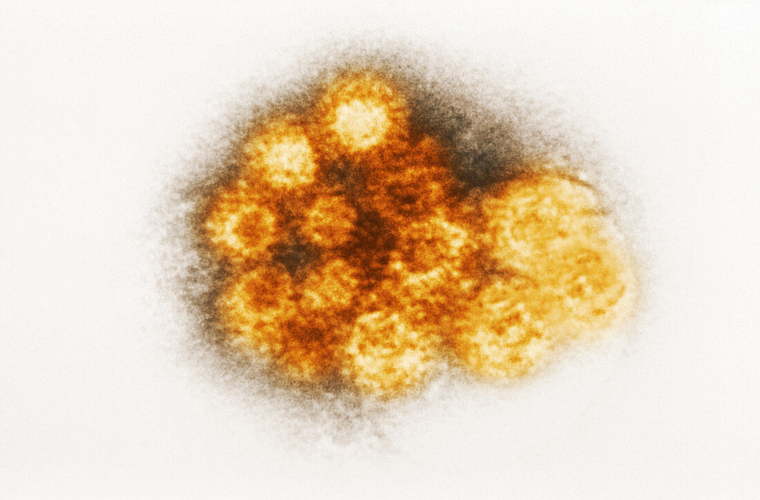 Enterovirus, TEM