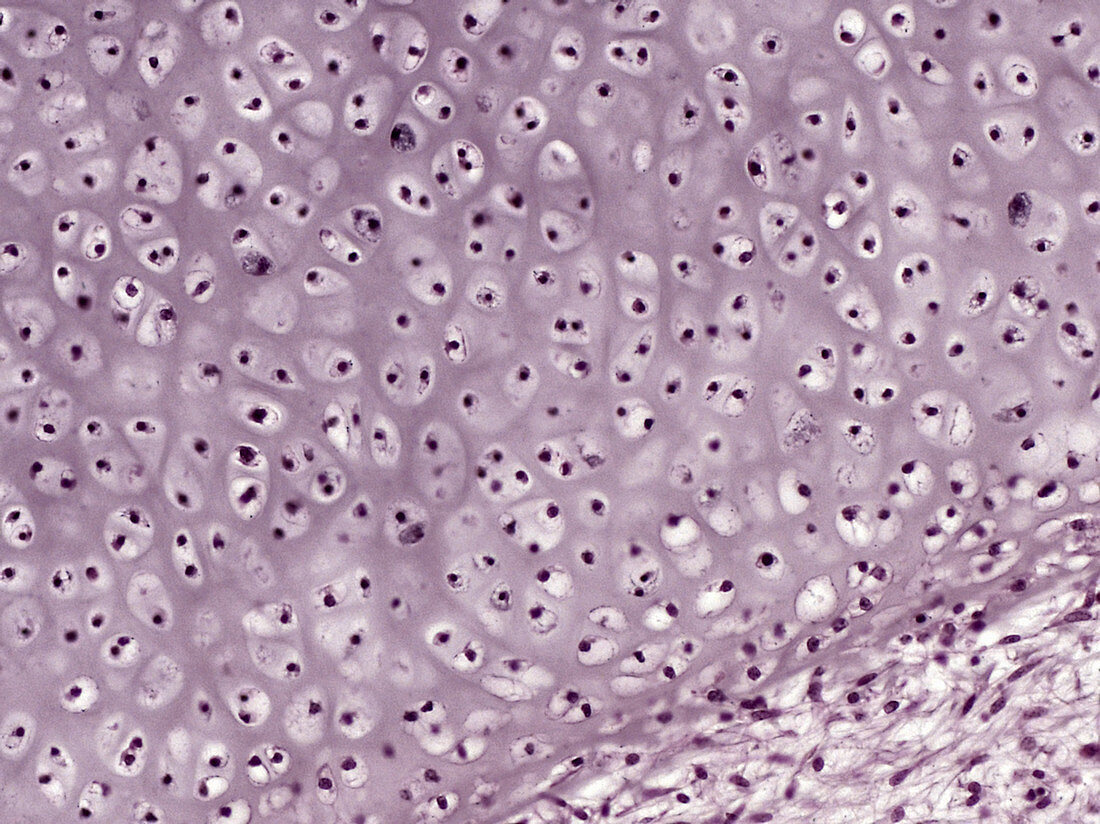 Embryonic Hyaline Cartilage, LM