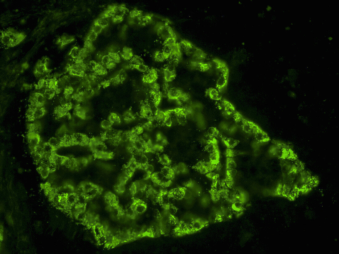 Pancreatic Islet Stained for A Cells, LM