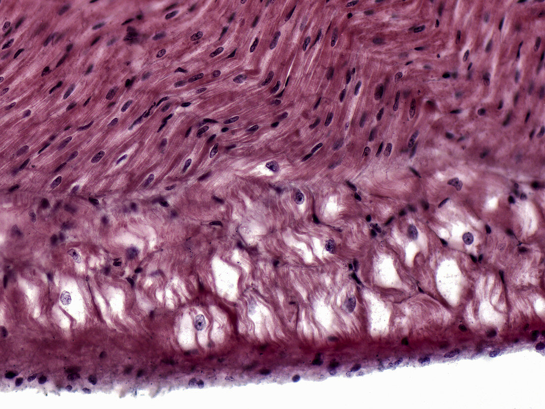 Cardiac Muscle with Purkinje Fibres, LM