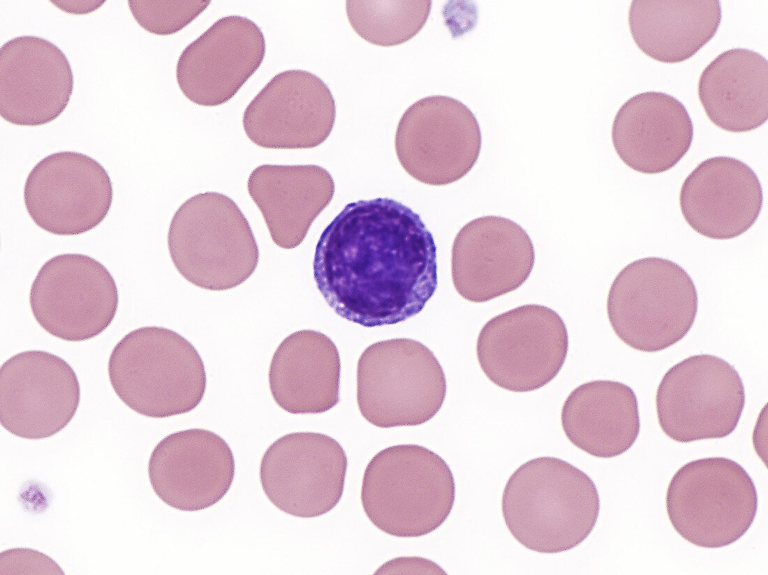 Red and White Blood Cells, LM