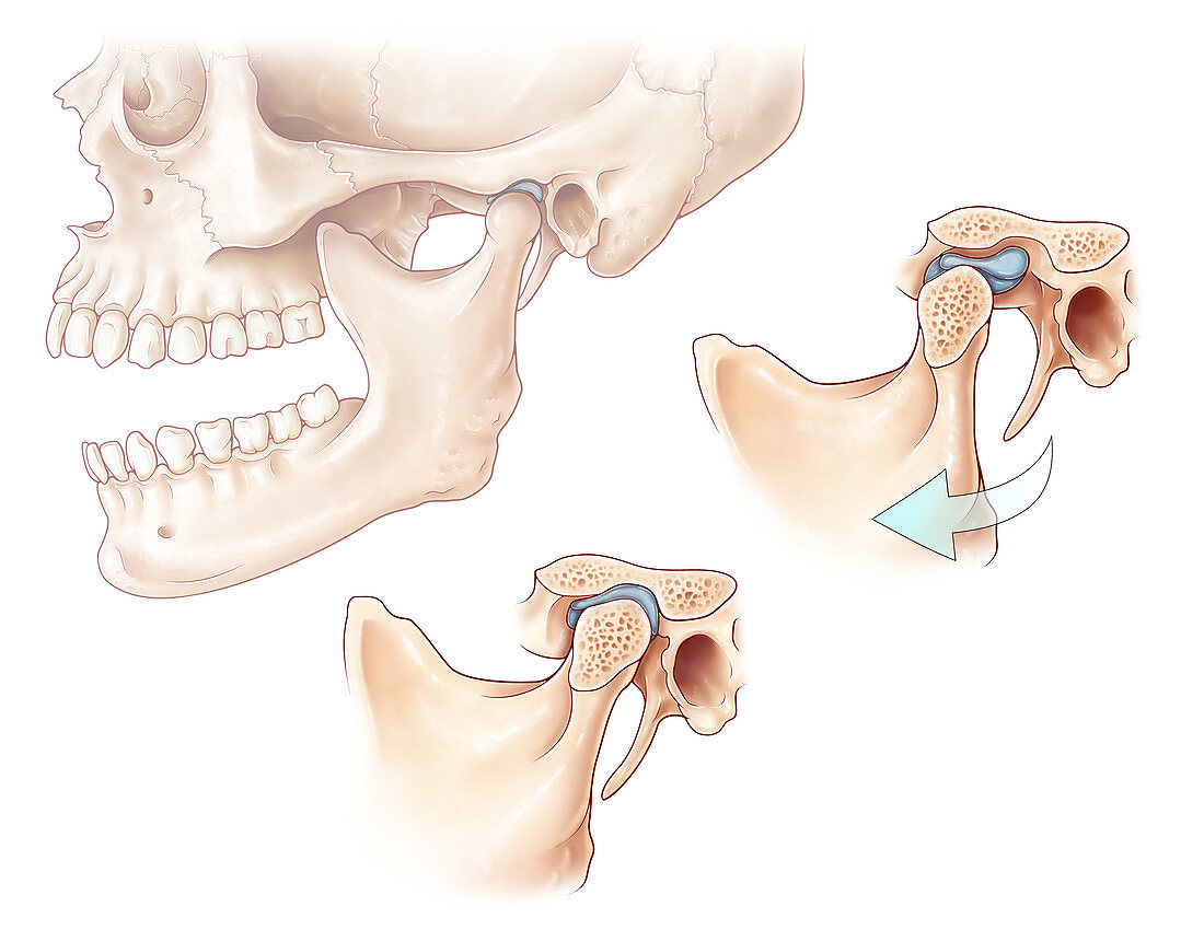Temporomandibular Joint, Illustration