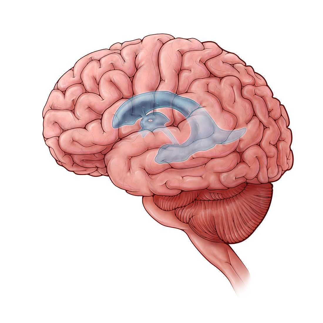 Lateral Ventricles, Illustration
