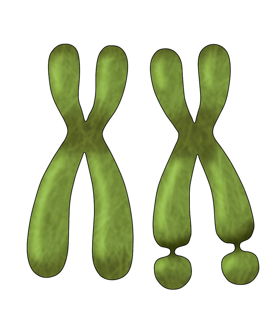 Fragile X Chromosome, Illustration