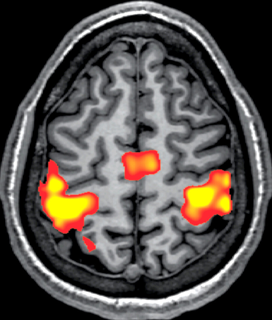 fMRI during Finger Tapping