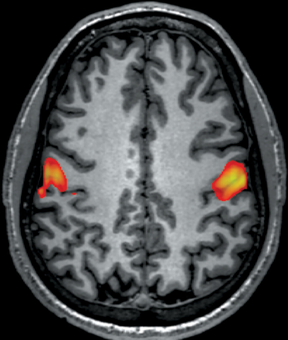 fMRI during Facial Grimacing
