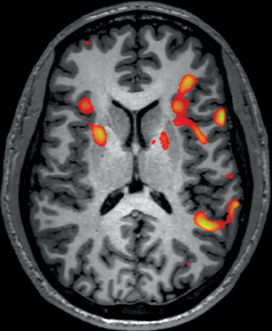 fMRI during Sentence Completion