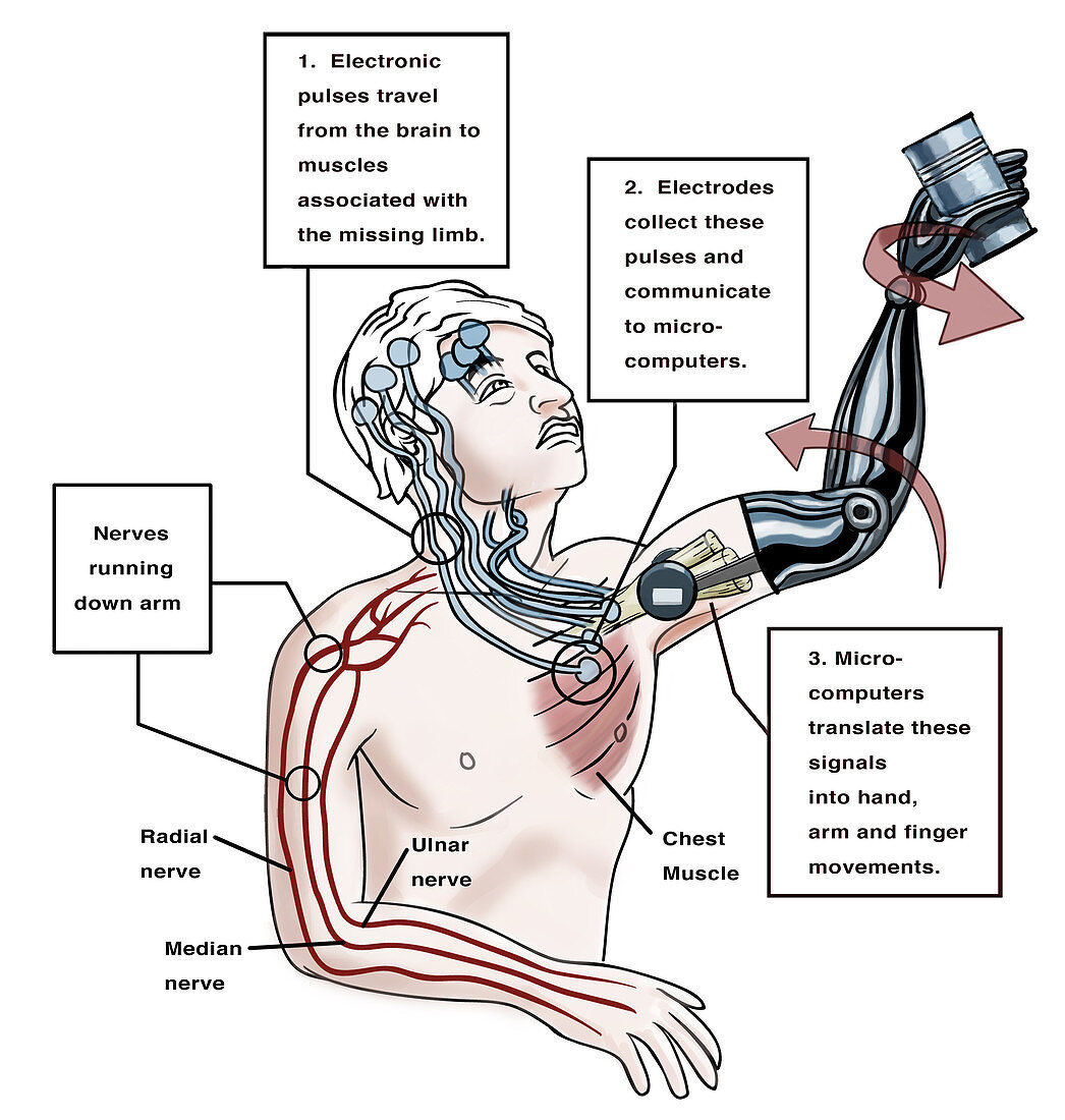 Prosthetic Robotic Arm, Illustration