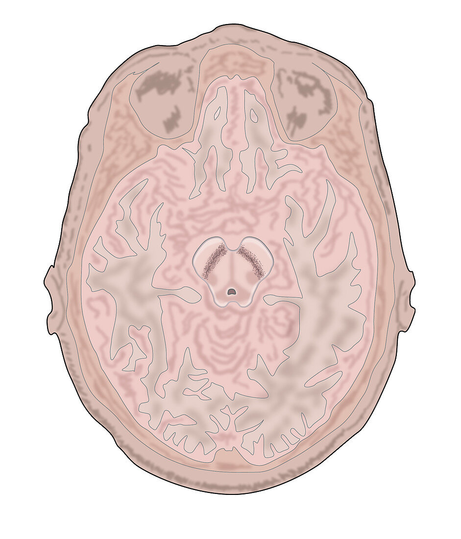 Brain Scan Slice, Illustration