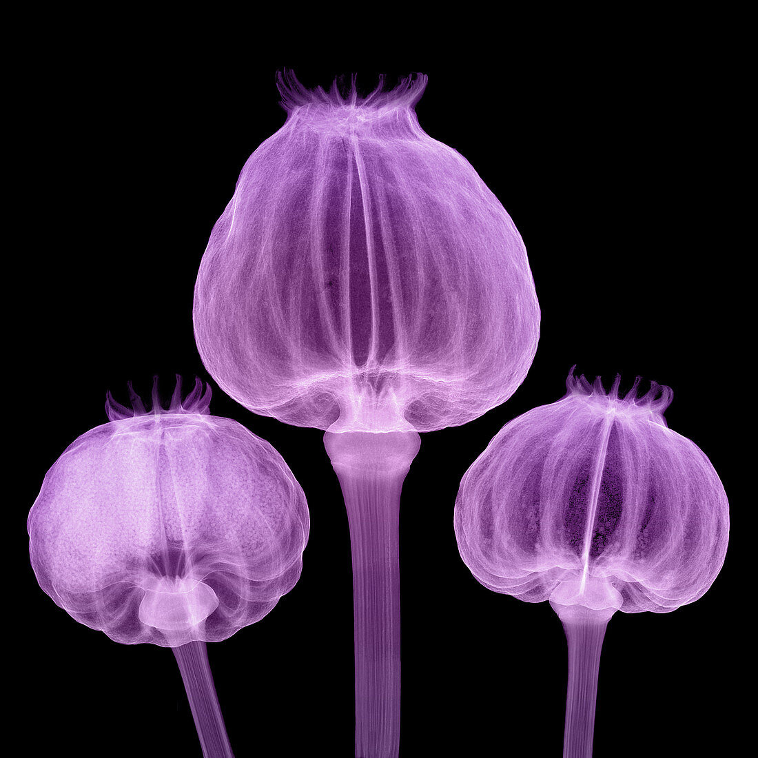 Opium Poppy Pods, X-ray