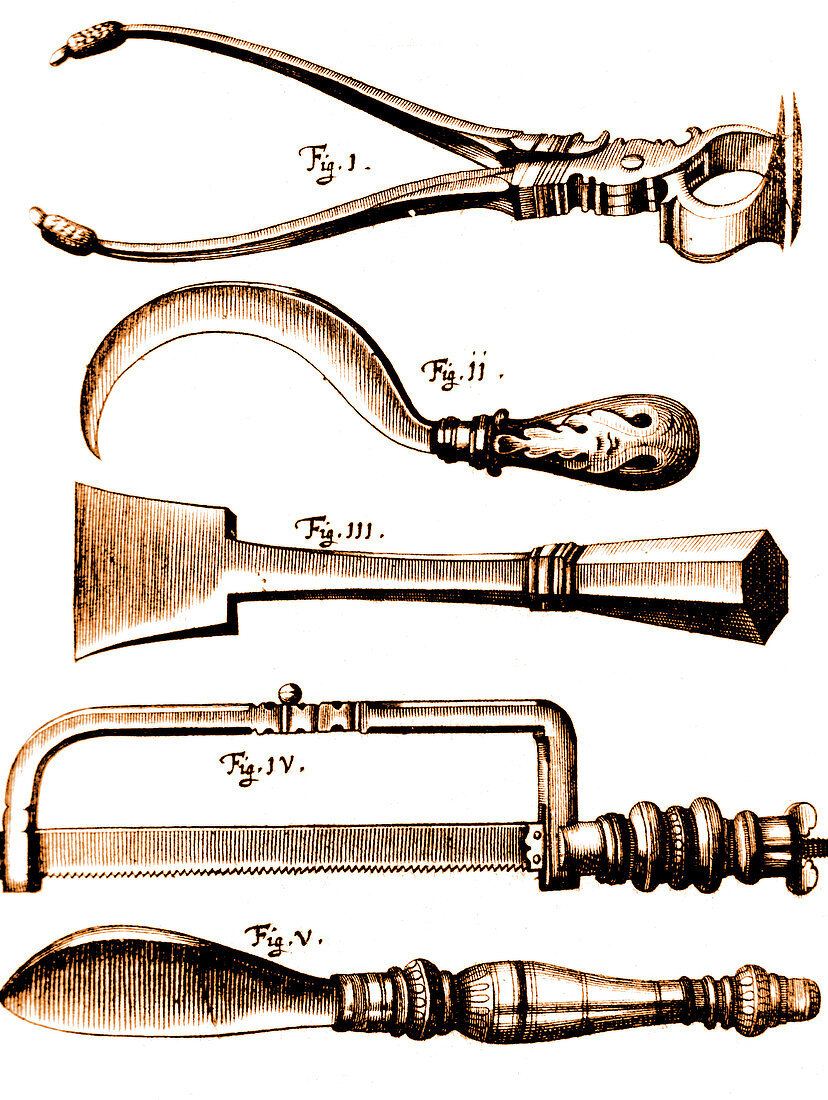 Amputation Instruments, 1772