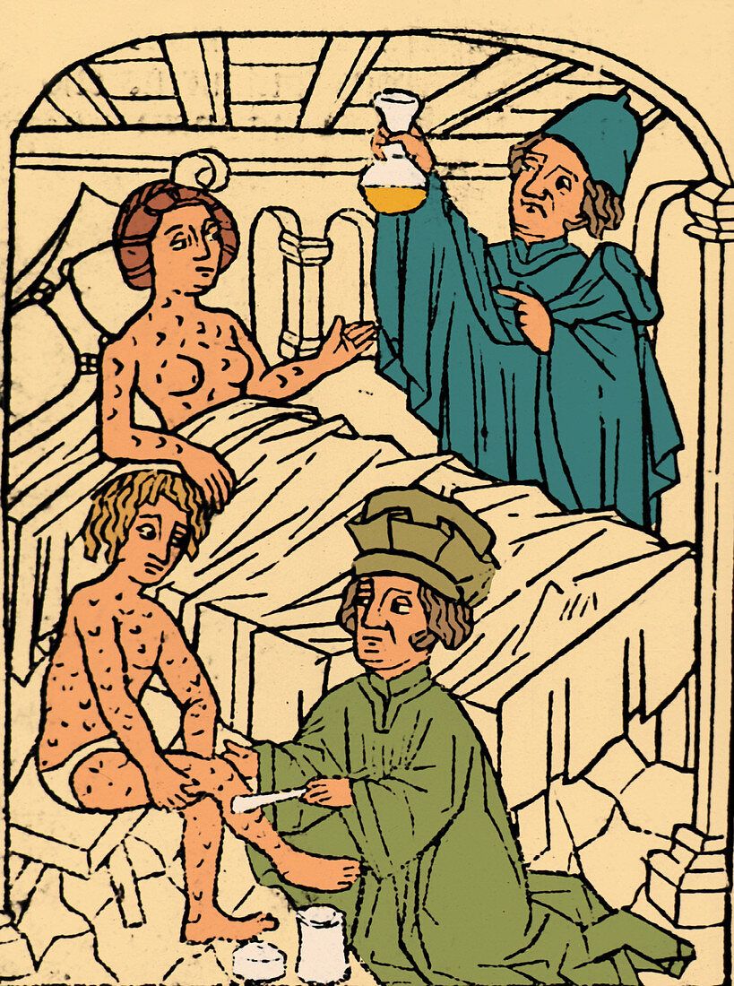 Uroscopy, Patients with Syphilis, 1497