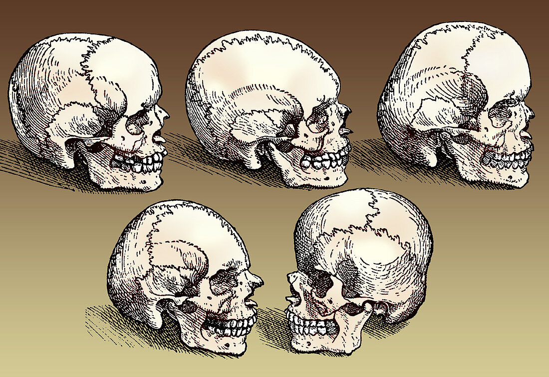 Normal and Abnormal Skulls, 16th Century