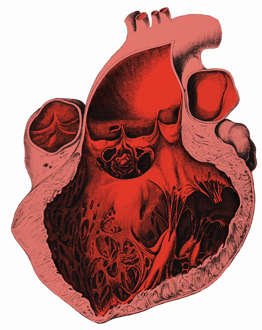 Heart Anatomy, Carl von Rokitansky, 1875