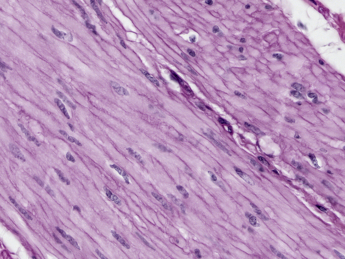 Smooth muscle, LM