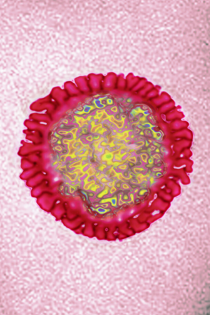 Influenza Virus, TEM