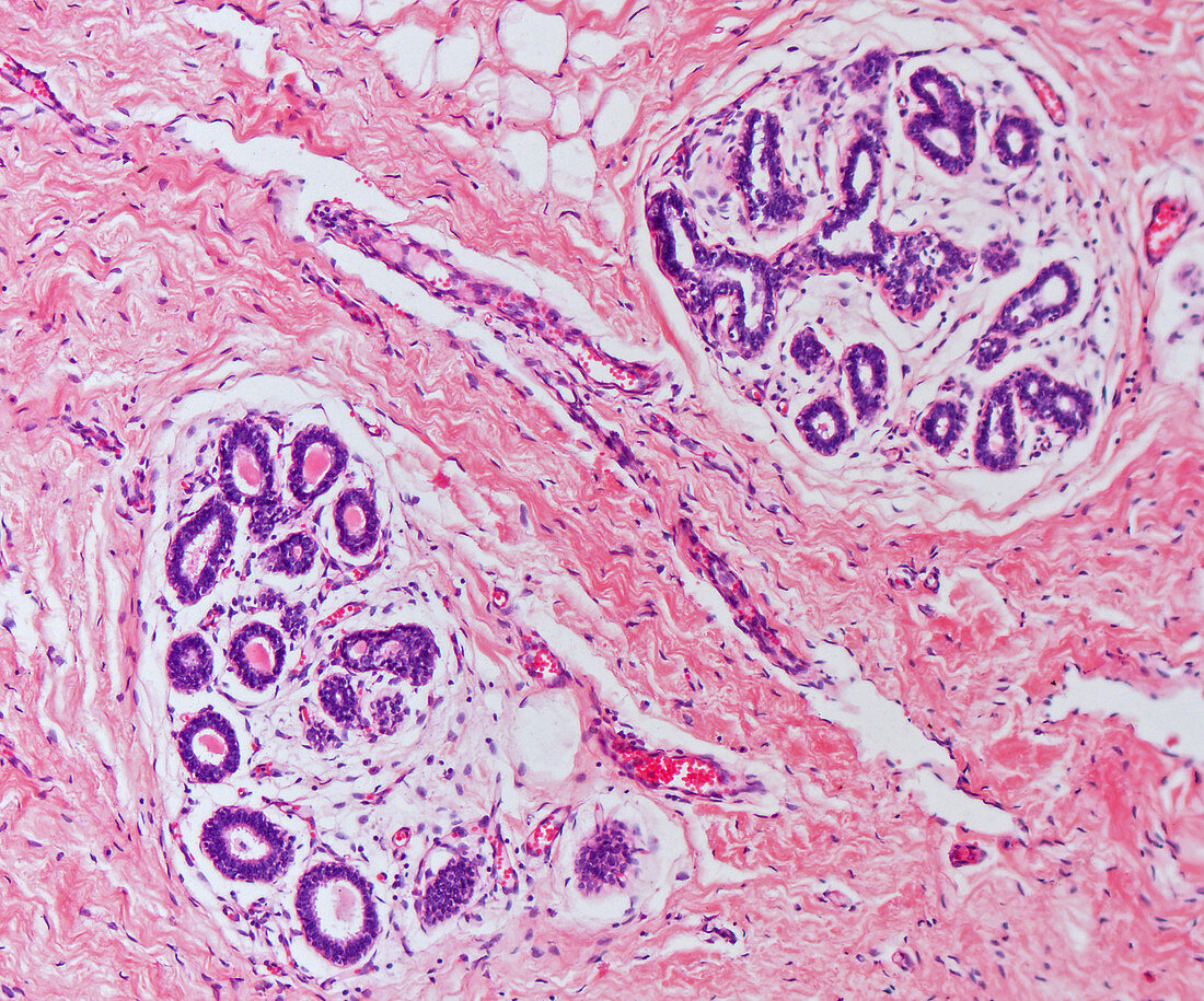 Mammary gland, human, inactive, LM