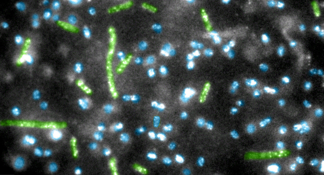 Quantum Dots bound to E.coli Bacteria