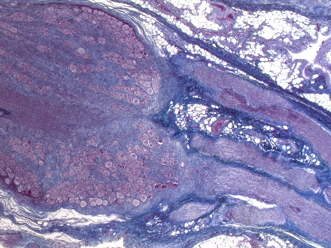 Dorsal root ganglion, human, LM