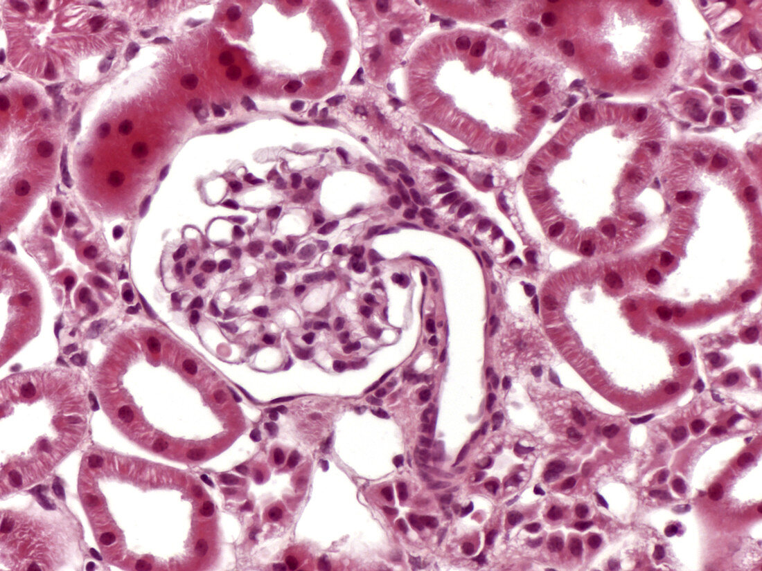 Kidney cortex glomerulus, LM