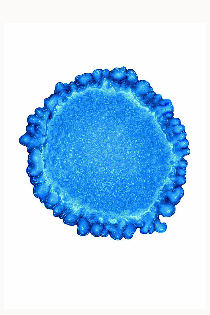 Flu virus, Orthomyxoviridae, TEM