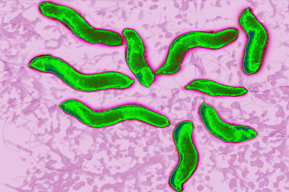 Helicobacter pylori bacterium, LM