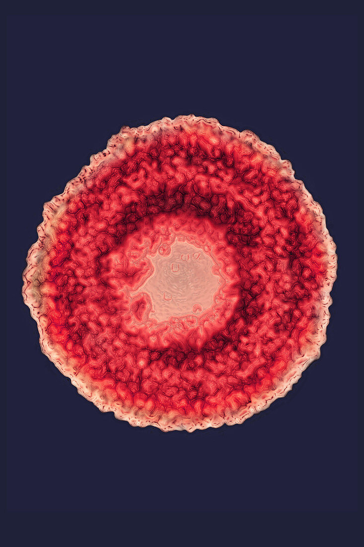 Herpes Simplex Virus 3, TEM