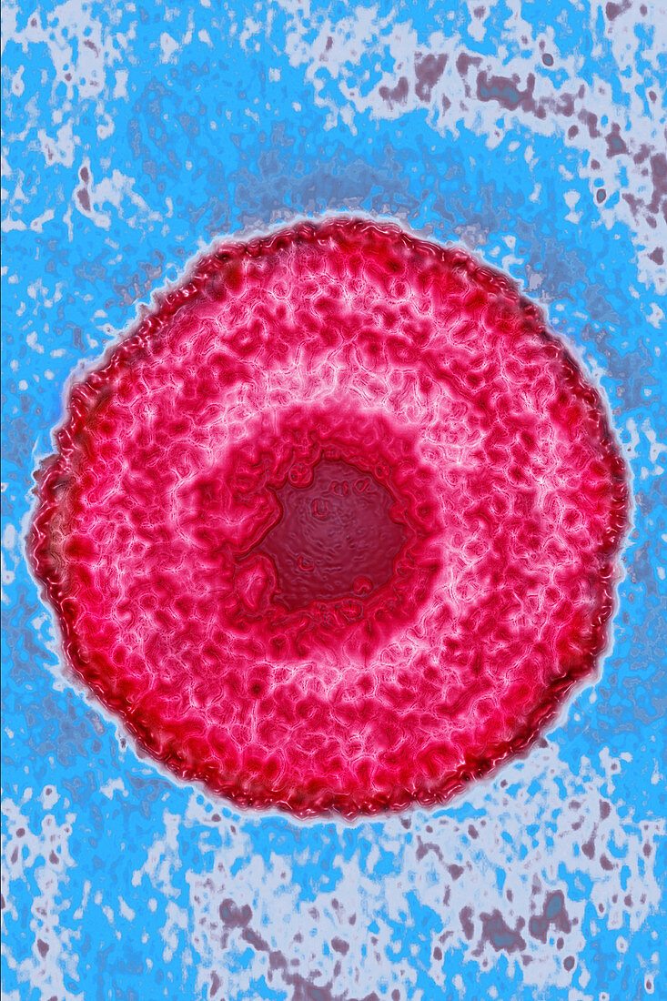 Herpes Simplex Virus 3, TEM