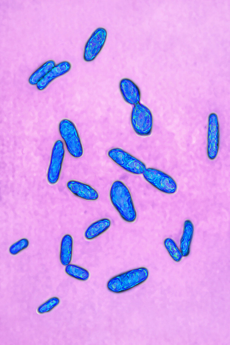 Clostridium tetani, LM