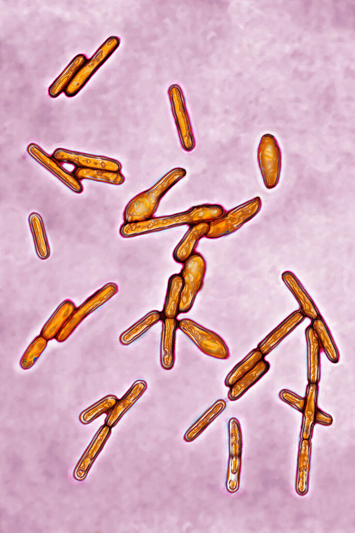Clostridium botulinum, LM