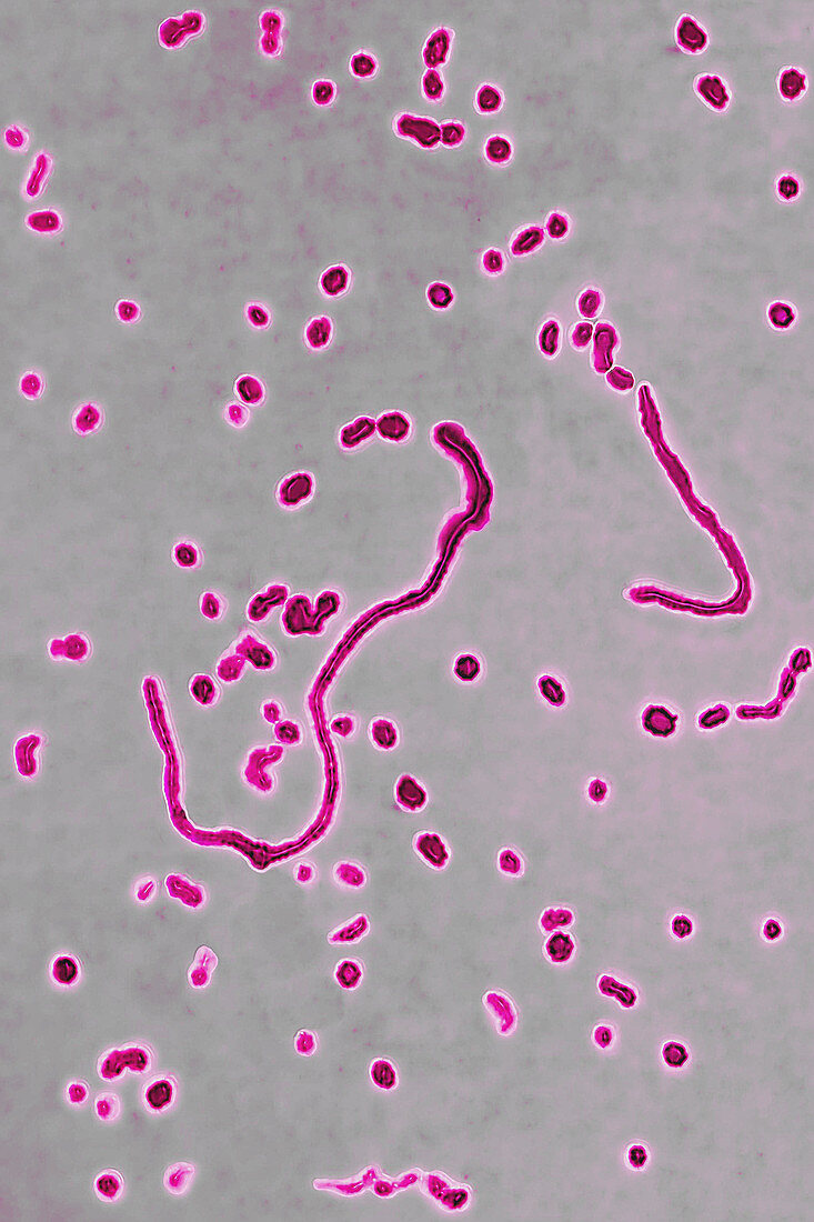 Haemophilus influenzae, LM