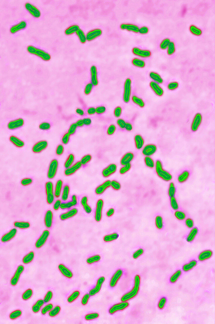 Bordetella pertussis, LM