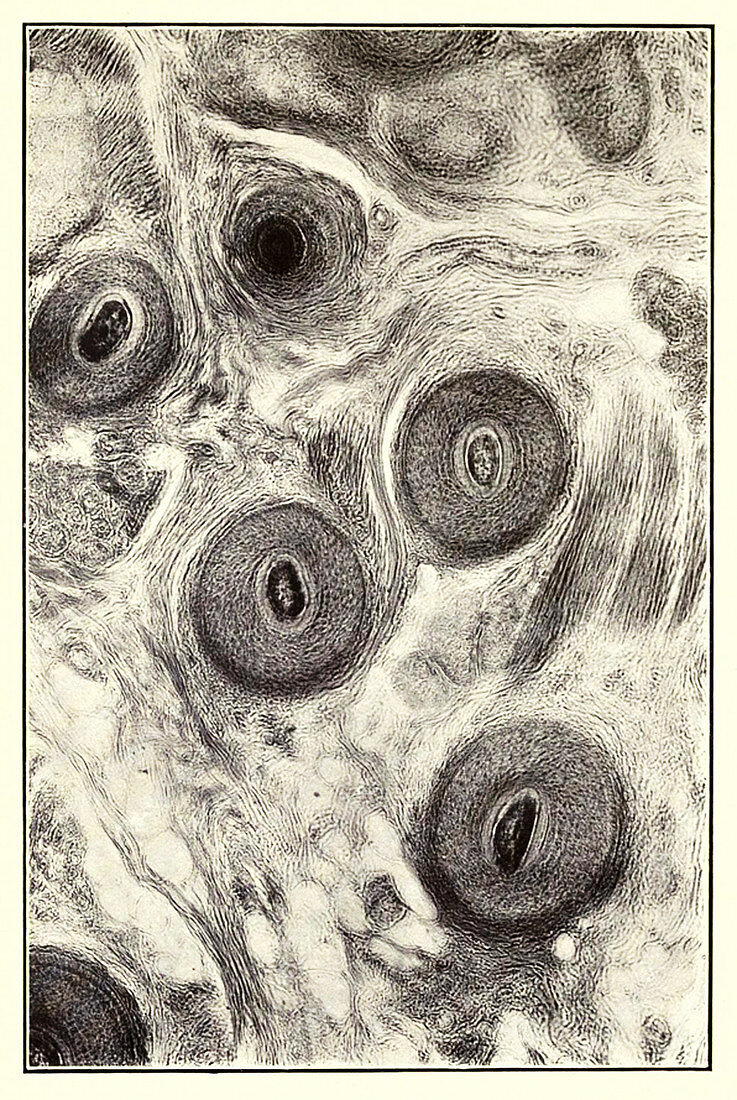 Human Scalp, Early Photomicrograph
