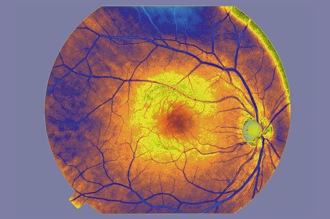 Fundus of the Eye