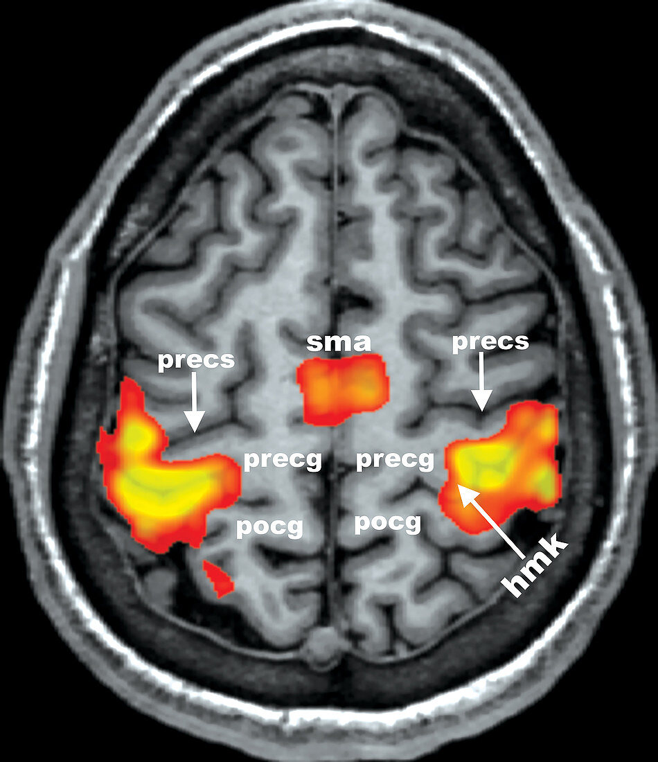 Finger Tapping, fMRI