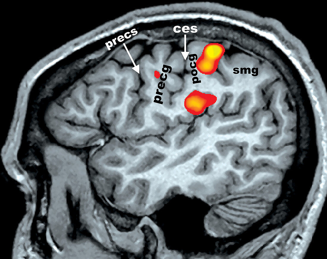 Sensory Task, fMRI