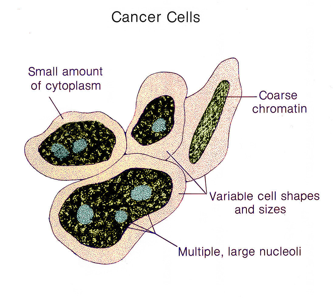 Cancer Cells, Illustration