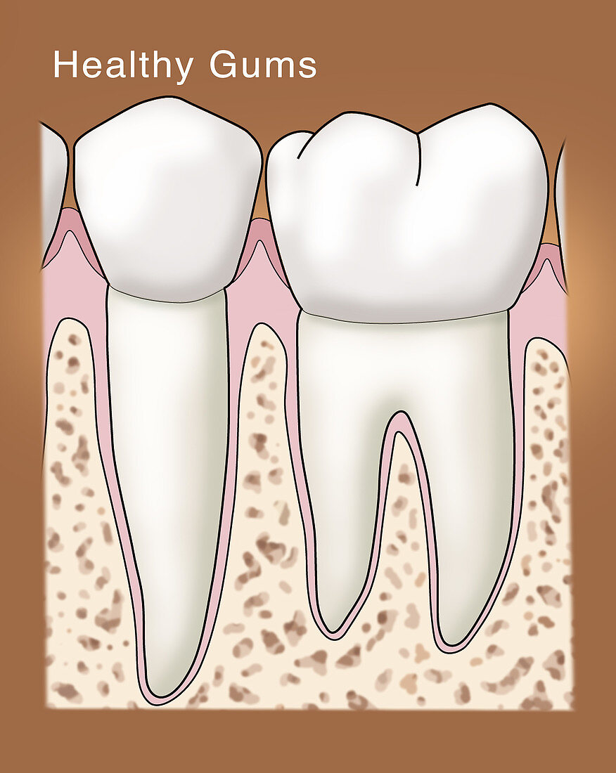 Healthy Gums & Teeth, Illustration