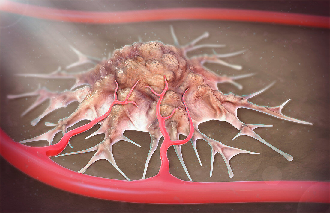 Tumour Angiogenesis, Illustration