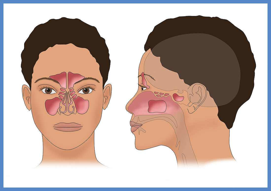 Sinus Anatomy, Illustration