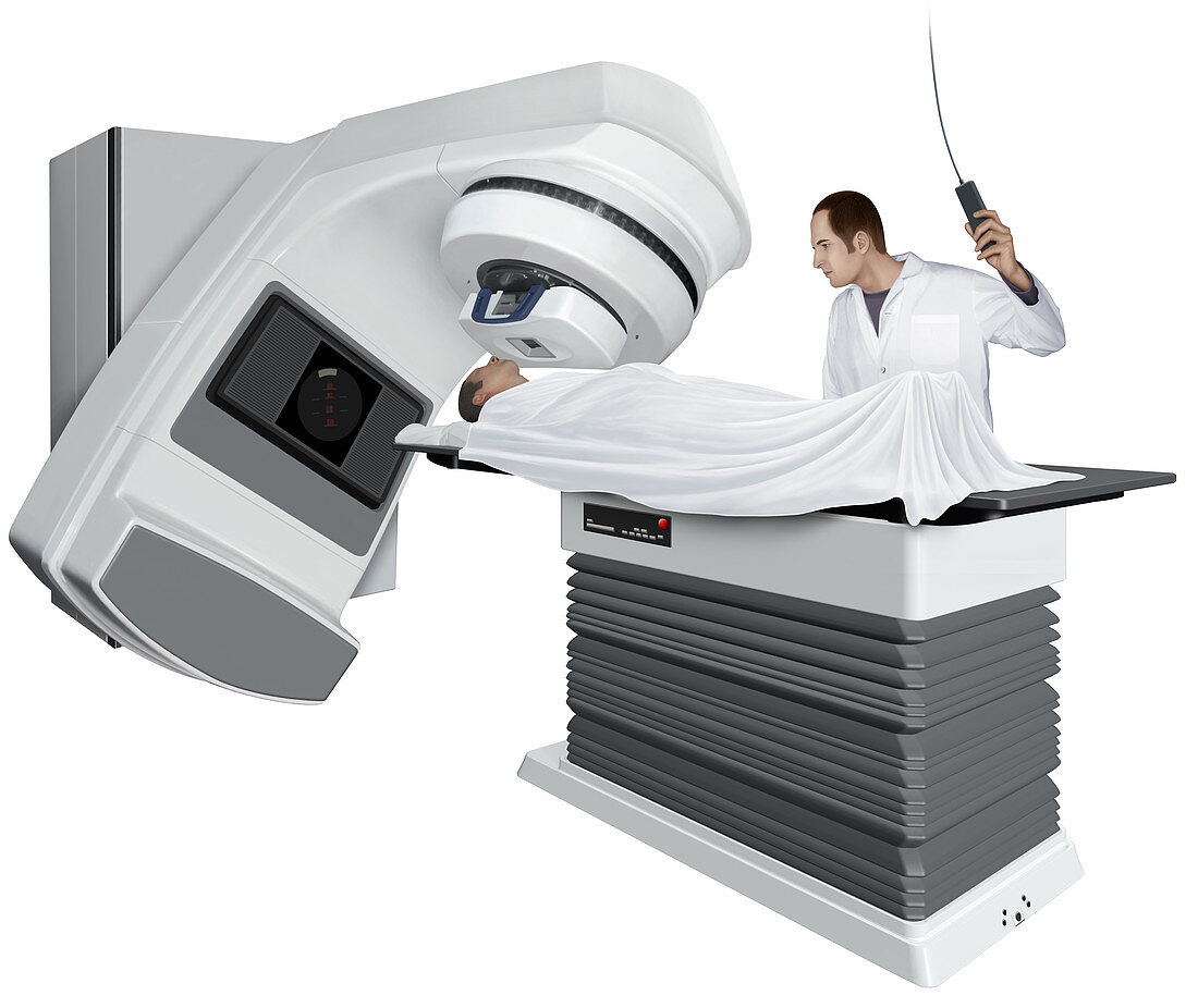 Radiotherapy, illustration