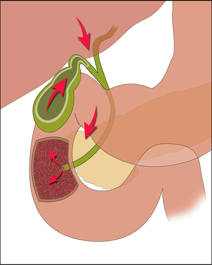 Gallbladder function, illustration