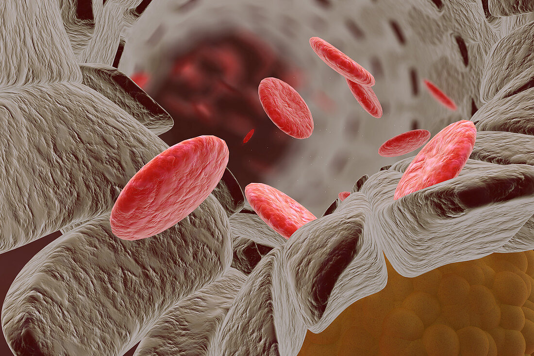 Cholesterol and Red Blood Cells, illustration