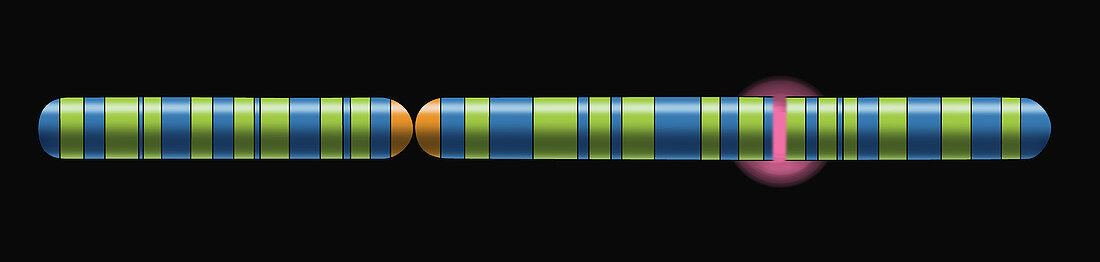 Cystic Fibrosis Chromosome, illustration